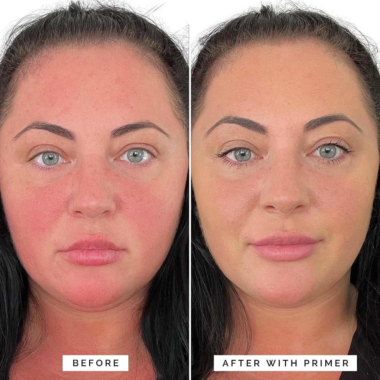 Before and after using long-lasting correcting face primer, reducing redness and smoothing the complexion.