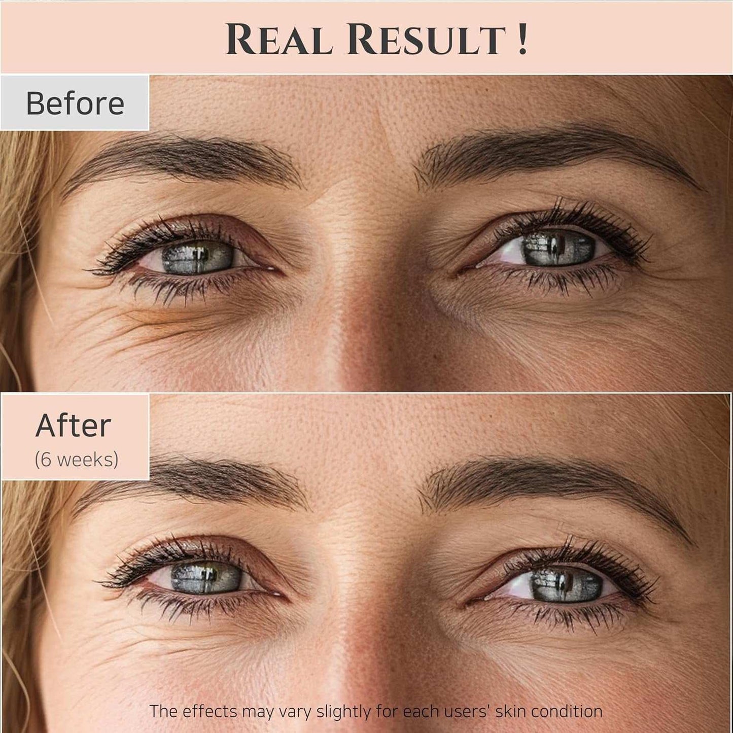 Before and after images showing reduced dark circles and fine lines around eyes after 6 weeks of using Revive Eye Serum