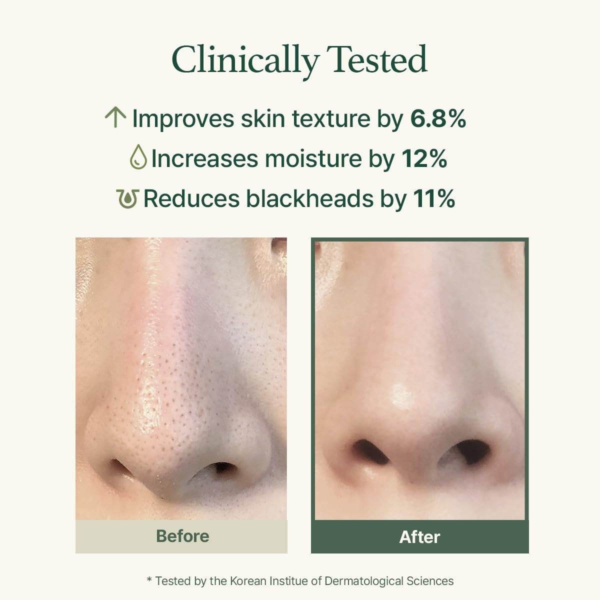 Before and after close-up images of nose showing reduced blackheads and improved skin texture after using deep cleansing face cleanser.
